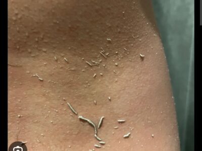 Esfoliação corporal coreana