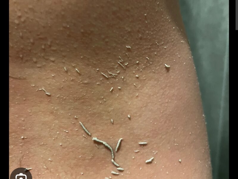 Esfoliação corporal coreana